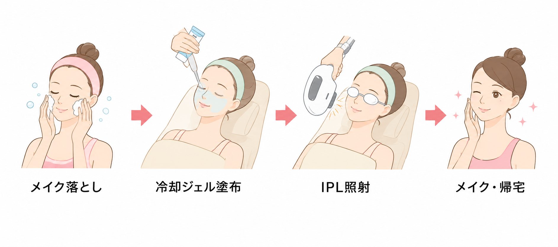 IPL治療当日の説明画像